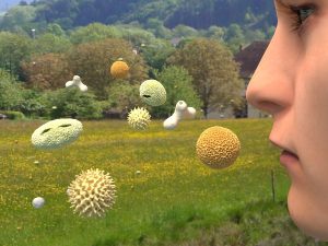 histamine intolerance