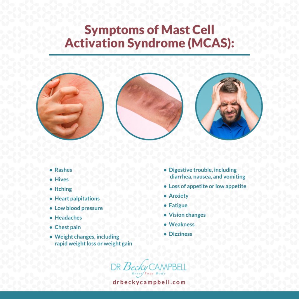 Symptoms of MCAS